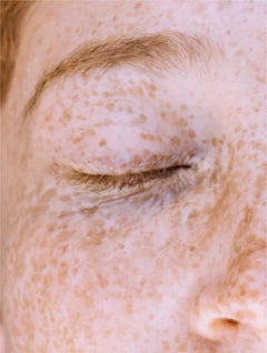 Sérum Vitamine C Éclat